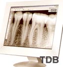 Dental x-ray Kodak RVG 6000, Digitale Radiographie-System