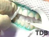 Zoom Zähne zahnärztliche Behandlung